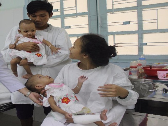 Hơn 400 ngày nằm viện cặp đôi dính liền sắp được về nhà