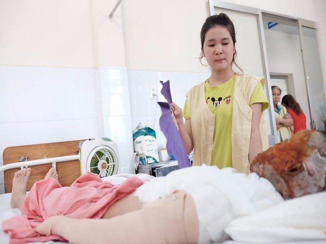 Éo le cô gái bị tạt acid hủy hoại khuôn mặt khi tan ca