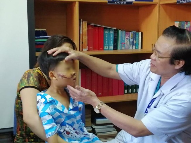 Nhiều trẻ không đội mũ bảo hiểm bị tai nạn thương tâm