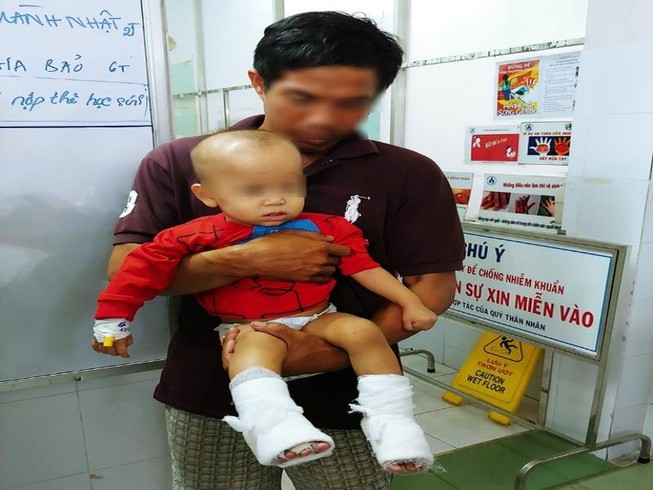Thương tâm nhiều trẻ bị tai nạn phỏng gần Tết