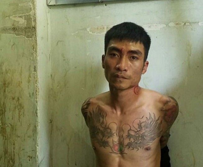 Nữ hộ sinh bị đánh vỡ hốc mắt, xương mũi trong thang máy