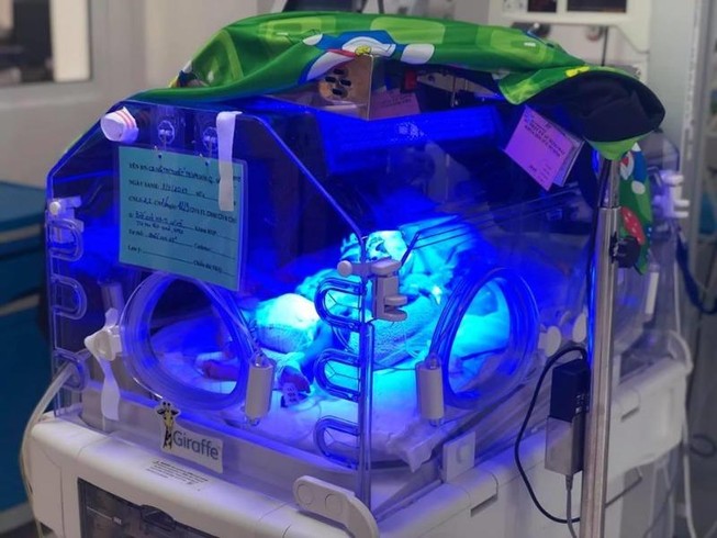 Bé gái vừa chào đời bị teo thực quản, không có hậu môn