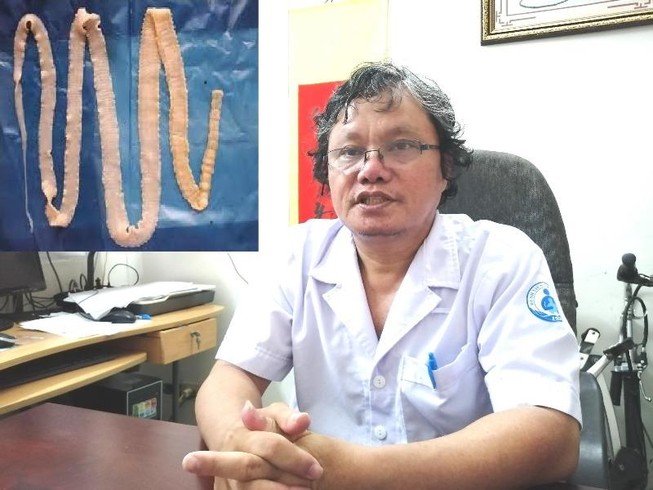 BS Khanh: Không nên quá lo khi con dương tính với sán lợn