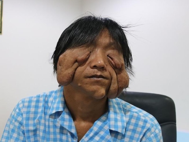 U 'quái' làm chàng trai khổ sở suốt 17 năm ròng
