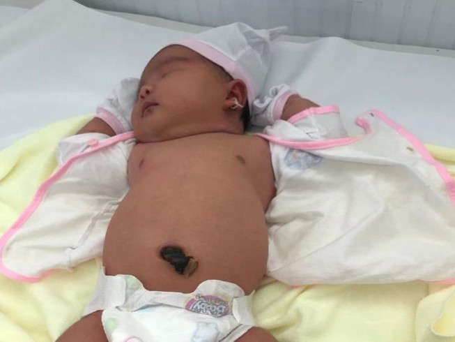 Bé gái cân nặng 5,2 kg chào đời an toàn