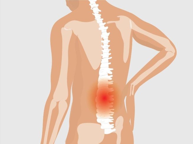 Cảnh báo viêm khớp cột sống gây tàn phế người trẻ