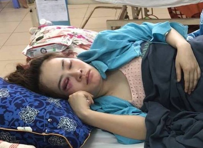 Cô gái bị đánh trong quán bánh xèo nộp đơn bãi nại