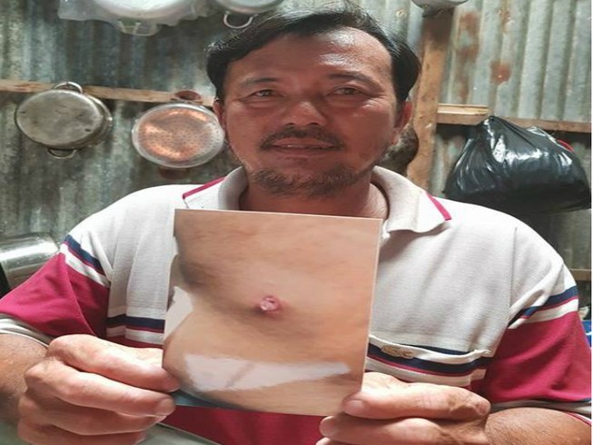 Làm rõ vụ dân tố bị cán bộ nổ súng bắn trúng lưng