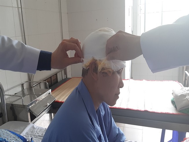 Sửa máy xay lúa, người phụ nữ bị lóc hết da đầu