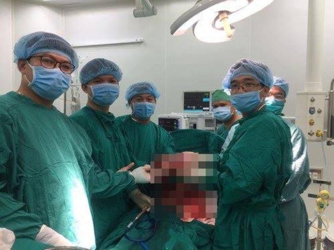 Khối u gần 3kg chiếm gần nửa bụng người đàn ông