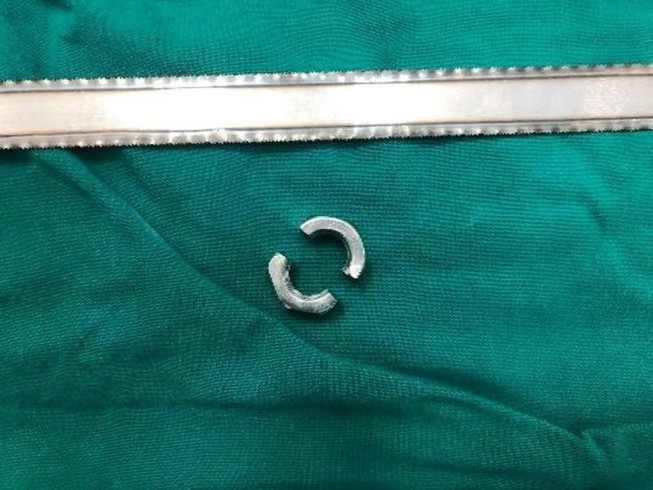 Vào viện cấp cứu vì đeo khoen kim loại cho dương vật