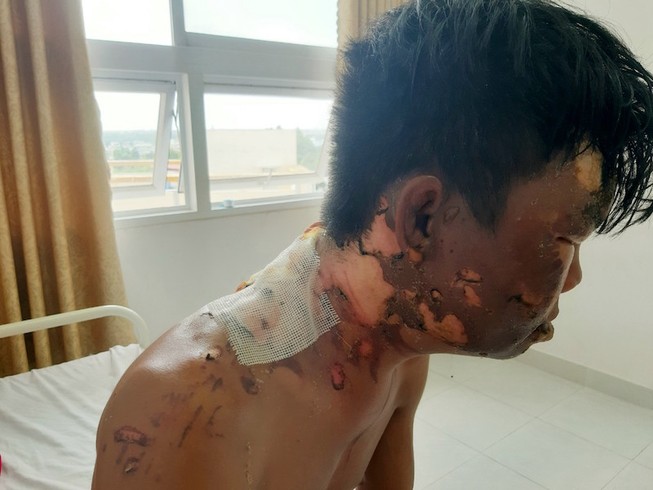 Mẹ ruột thanh niên bị chị tạt nước sôi trần tình