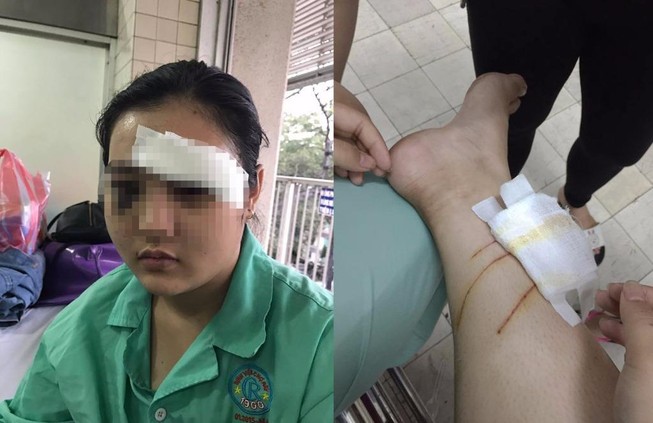 Công an thông tin vụ 'cô gái 16 tuổi bị cắt tai'