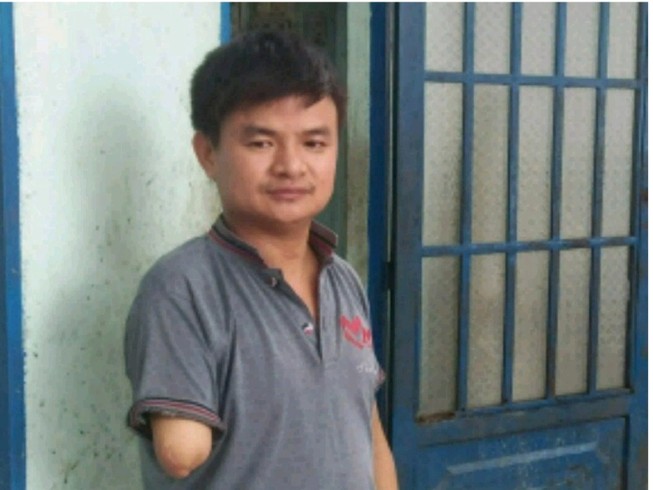 Sắp xử lại vụ 'đòi đền cánh tay'