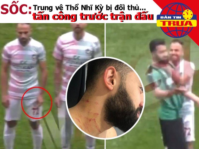 Cầu thủ Thổ Nhĩ Kỳ bị tấn công, Sarri từng muốn giết Kepa