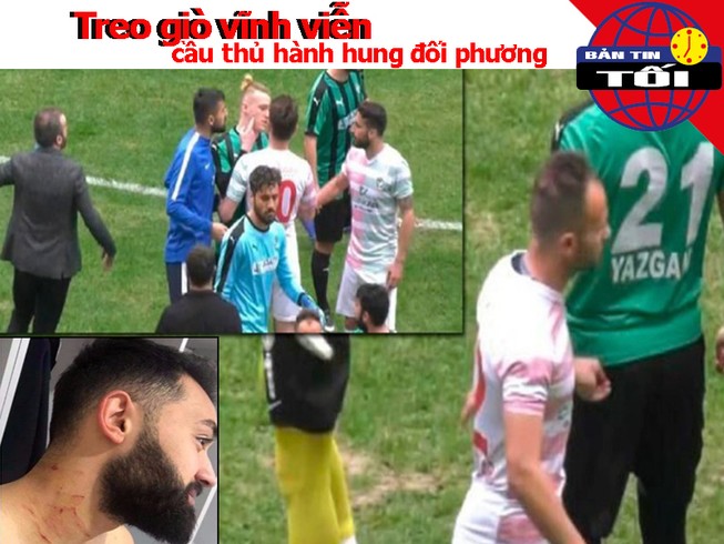 Bị treo giò vĩnh viễn vì hành hung cầu thủ đội bạn
