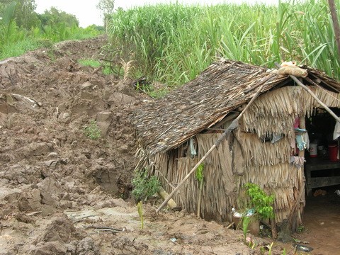 Bé 5 tuổi bị mẹ kế đánh nhập viện