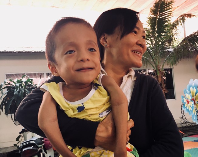 “Có bé chỉ nằm một chỗ hắt xì cũng gãy xương…”