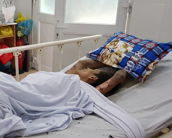 Thanh niên ngáo đá nhốt bạn gái, đốt phòng trọ ở Thủ Đức