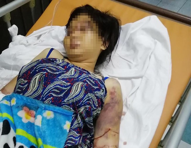 Phẫn nộ: 22 ngày cô gái bị tra tấn dã man, dẫn đến sẩy thai