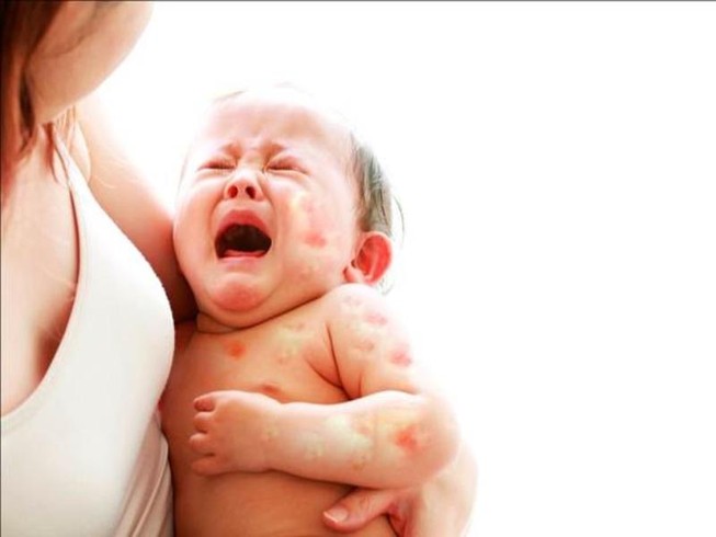 Vì sao một số trường hợp trẻ nhỏ uống sữa bò lại bị đau bụng?