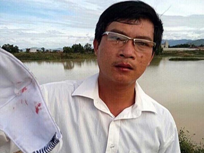 Giám đốc doanh nghiệp đánh phó chủ tịch xã nhập viện