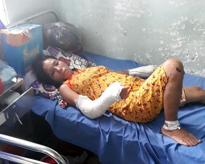 Công an lý giải vì sao chưa bắt khẩn cấp kẻ đánh vợ dã man