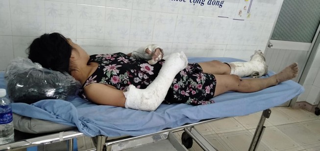 Bị khởi tố nhưng kẻ đánh vợ có thai vỡ nền sọ đã bỏ trốn