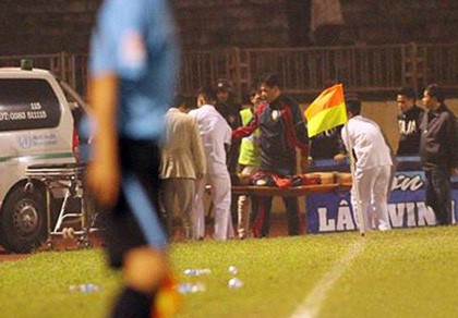 Thêm một cầu thủ V-League bị đạp gãy xương ống chân