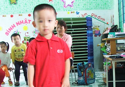 Bé 3 tuổi bị cô giáo đánh tím người vì liên tục vào nhà vệ sinh