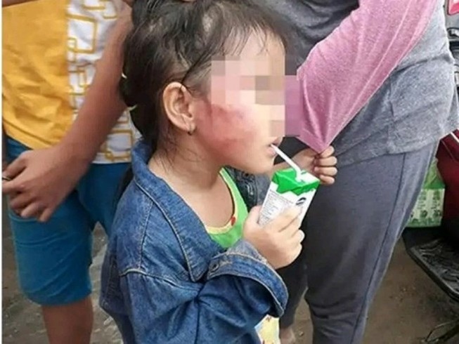 Khởi tố, bắt tạm giam cô giáo bạo hành trẻ ở Bình Chánh