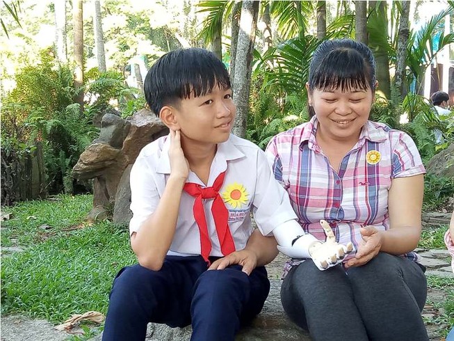 Cánh tay robot từ ngày hội hoa hướng dương