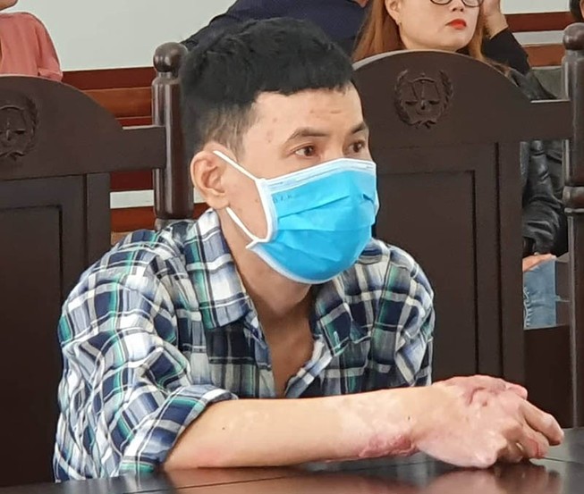 Kẻ tưới xăng đốt vợ bị phạt 16 năm tù