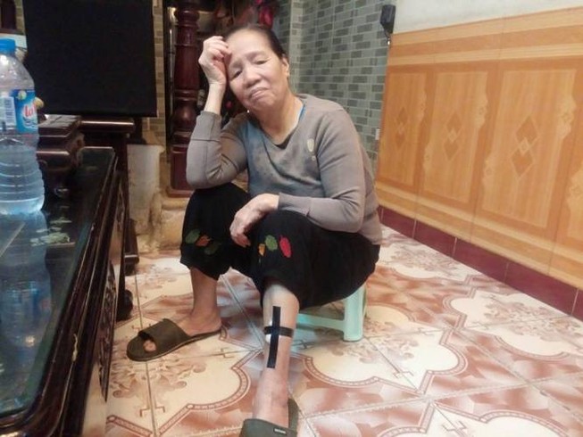 Luật sư phân tích pháp lý trong vụ 4 con chó lao vào cắn chủ