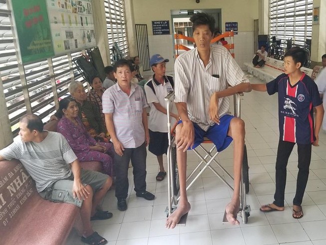 Người cao 2,5 m ở Cà Mau tiếp tục cao thêm 5 phân