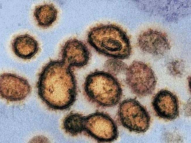Virus SARS-CoV-2 dưới kính hiển vi. Ảnh: AFP