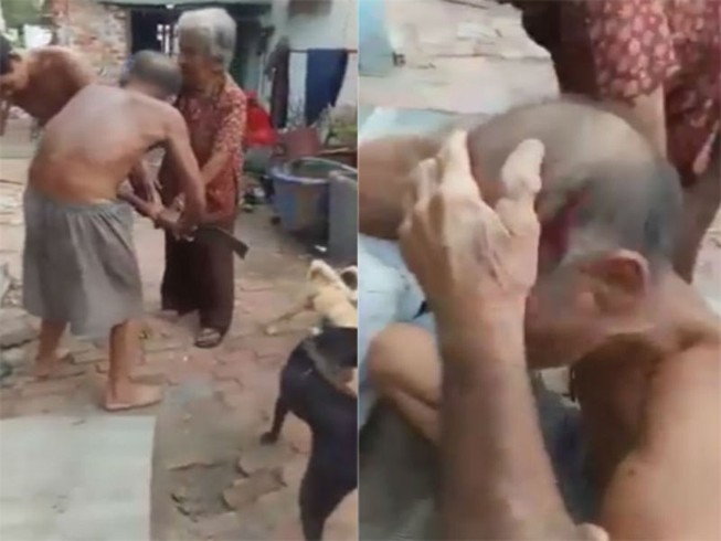 Gã nghiện rượu đánh cha ruột 84 tuổi chấn thương