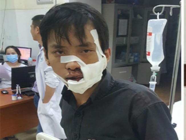 Chém nhau kinh hoàng trên phố, 5 người nhập viện