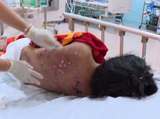 Bắt thêm 3 người tra tấn dã man cô gái bán cà phê