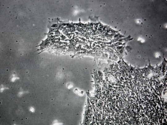 Phát hiện loại virus khiến con người bị ngớ ngẩn