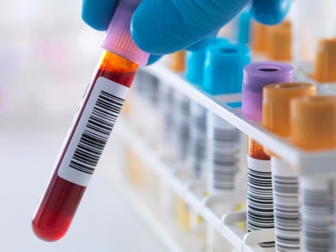 Bé 8 tuổi ‘đánh bại’ virus HIV
