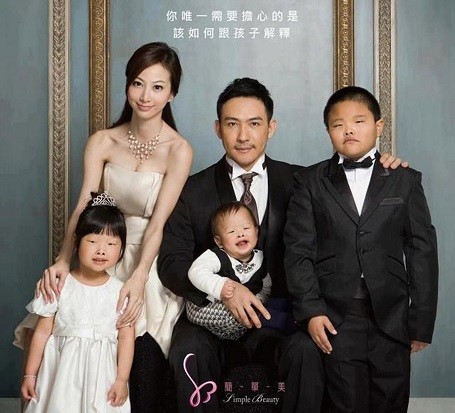 Sự thật sau bức ảnh 'phẫu thuật thẩm mỹ không thể thay đổi gen'