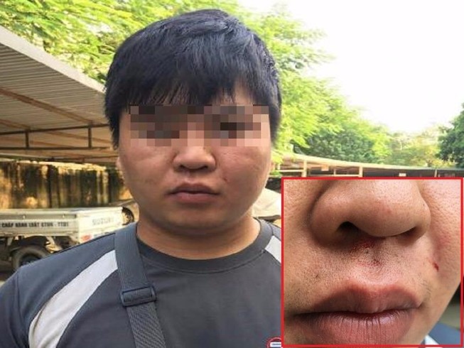 Phóng viên bị hành hung khi vừa rời khỏi UBND phường