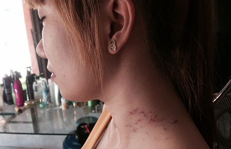 Nữ chủ tiệm chống kẻ cướp cầm dao
