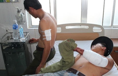 Hàng chục lâm tặc vây chém kiểm lâm
