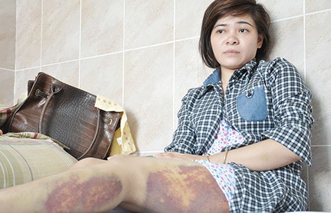 Đánh nghi can để truy xét vụ trộm điện thoại