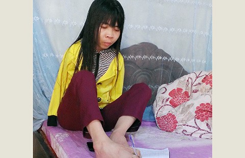 Người phụ nữ bị mang đi giấu vì … dị dạng