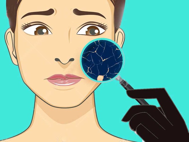 Đưa người trong mộng vào khách sạn để... hiếp dâm?