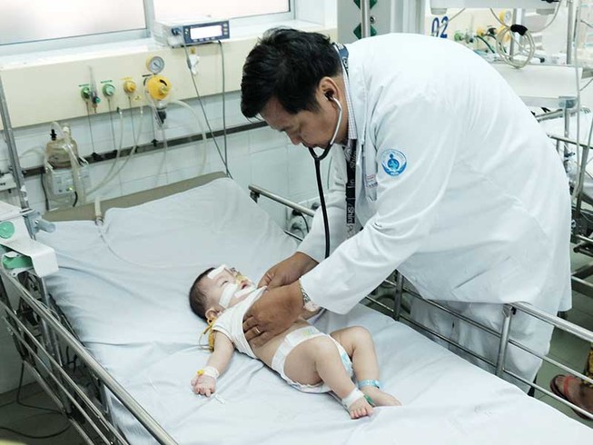 Trẻ mắc động kinh ngang mức thế giới
