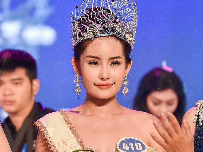 Hoa hậu Đại dương: Đã phẫu thuật, phải tước vương miện